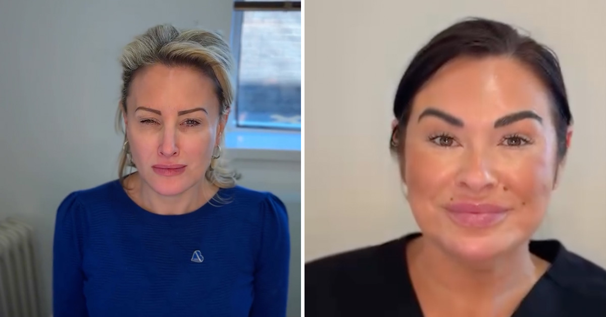 A Bunch of Women With Botox Attempt to Frown thumbnail