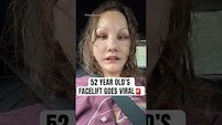 52 YEAR OLD'S FACELIFT GOES VIRAL! "I Don't Recognise Myself Anymore" thumbnail
